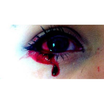 Dieses Mädchen weint Blut