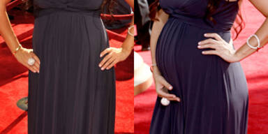 Best Dressed: Babybauch