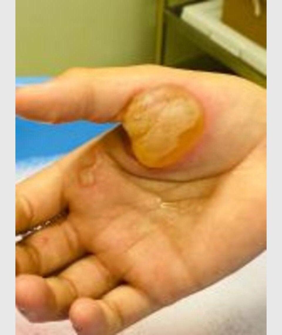 Junge (14) landet nach Squid Game-Challenge im Krankenhaus