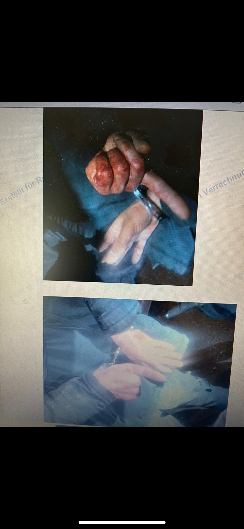 Mordversuch Albaner Wien Prozess