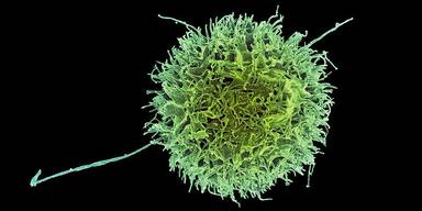 Nat&uuml;rliche Killerzelle