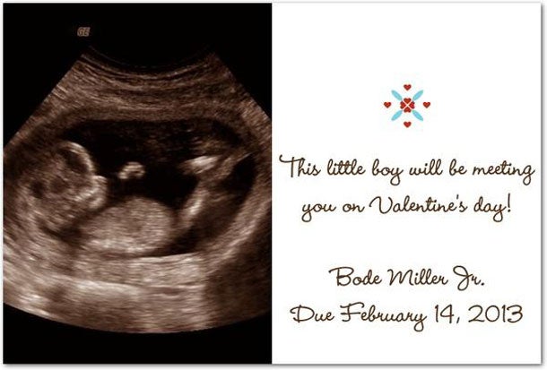 Bode Miller, Sara McKenna