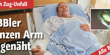 ÖBBler ganzen Arm angenäht