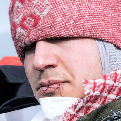 Flüchtlinge nähen sich aus Protest die Münder zu