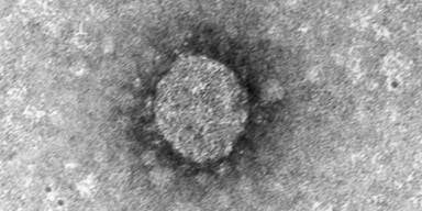 Coronavirus: Gutachter sehen Entsch&auml;digungsanspruch f&uuml;r Betriebe