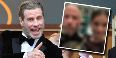 John Travolta Glatze