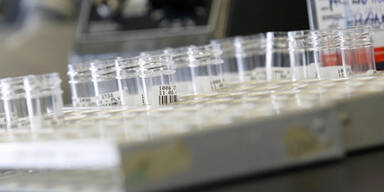 Österreich in Angst vor Superbakterien