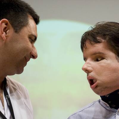 Oscar mit seinem neuen Gesicht