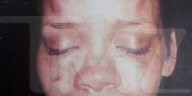 So schlimm wurde Rihanna verprügelt