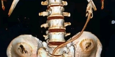 Stopthebleedpoland/Facebook