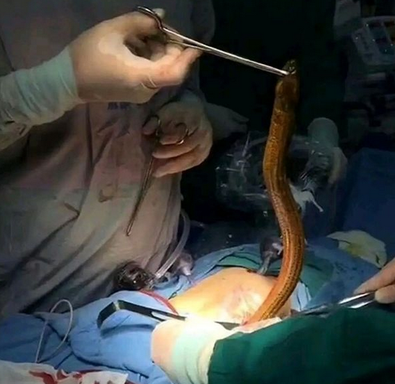 Stopthebleedpoland/Facebook