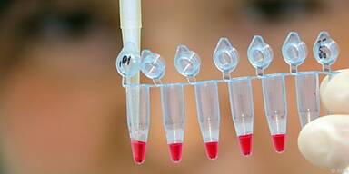 Adulte Stammzellen gelten als Hoffnungstr&auml;ger