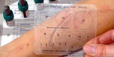 Allergiepass befragen