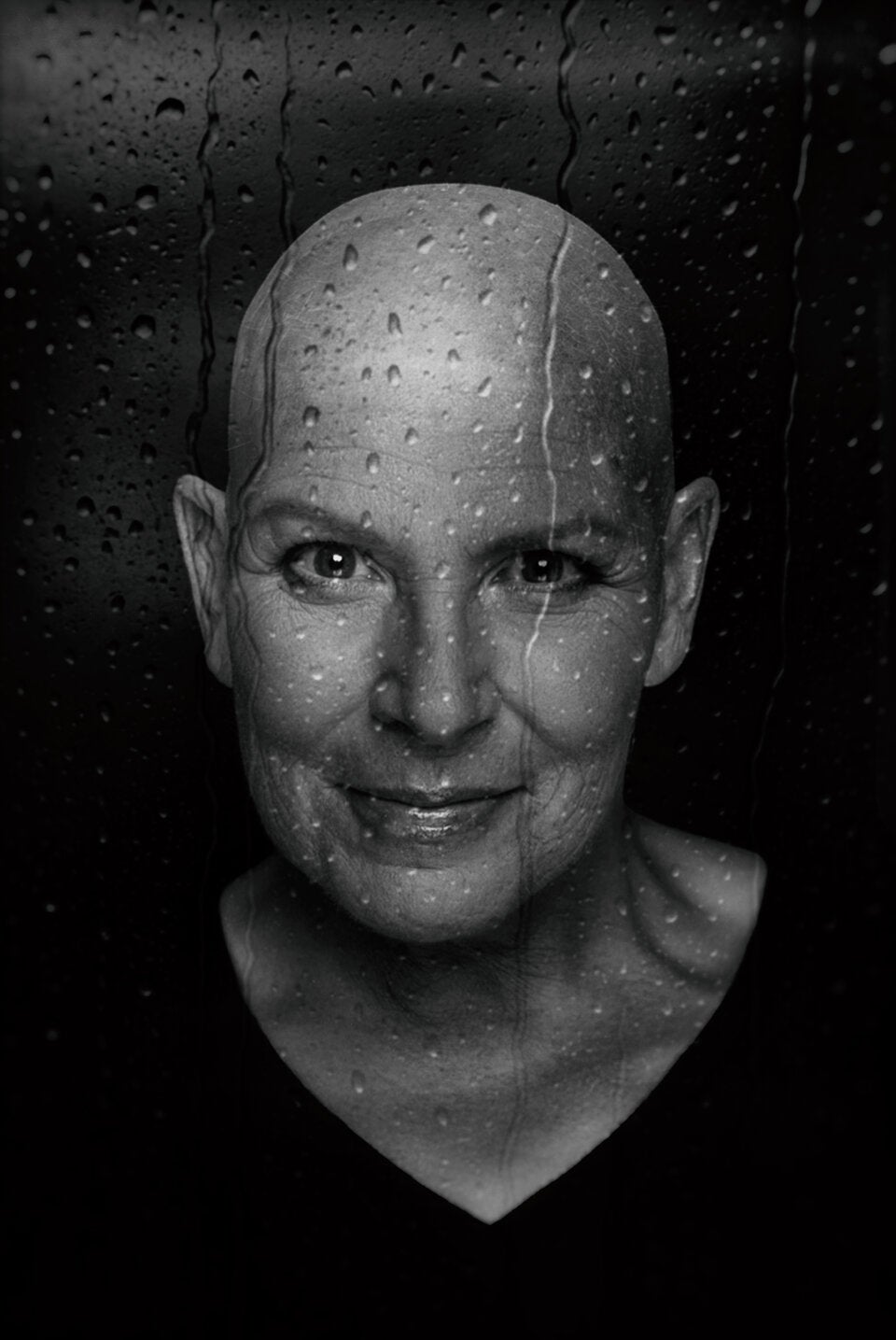 Andrea Kdolsky zeigt sich mutig mit Glatze. 