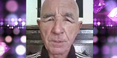 Beauty- OP entstellte diesen Prinzen!