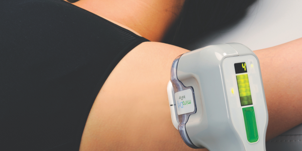 Schwitz-Stopp für immer mit innovativer miraDry®-Behandlung