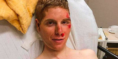 Horror-Stürze von Schweizer Rad-Stars