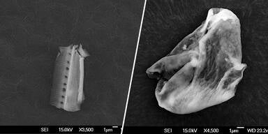 au&szlig;erirdische Mikroorganismen