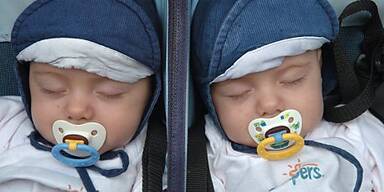 BPA wirkt schon in geringen Mengen sch&auml;dlich