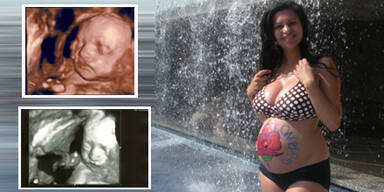 Das 'Baby-Bambi' hat schon ein Gesicht