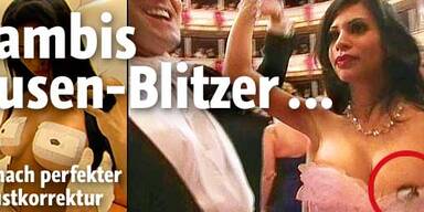 Lugner-Ex sorgte für nackte Tatsachen