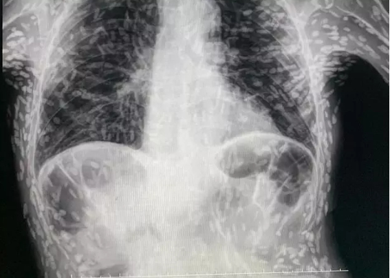 Twitter/Vitor Borin de Souza