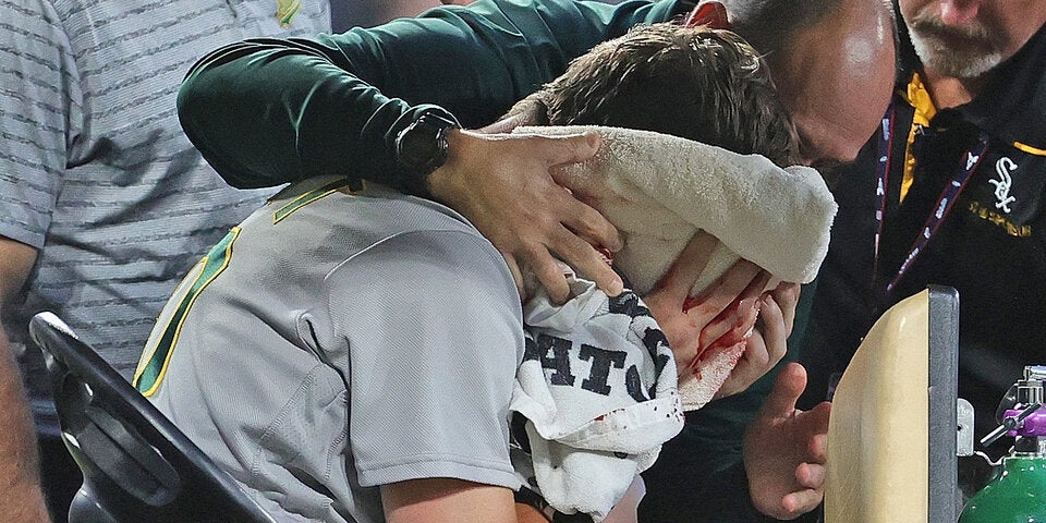 Blutiger Baseball-Schock in MLB