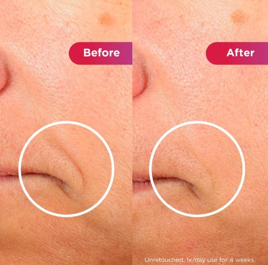 Shark CryoGlow LED-Maske + Kühlung der Augenpartie – Lila FW312EUPL