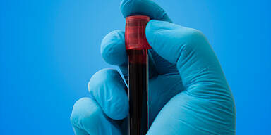 Sensation: Nur eine Person auf der ganzen Welt hat DIESE Blutgruppe
