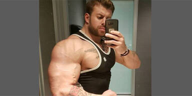 Bodybuilder bei&szlig;t Taxler Ohr ab