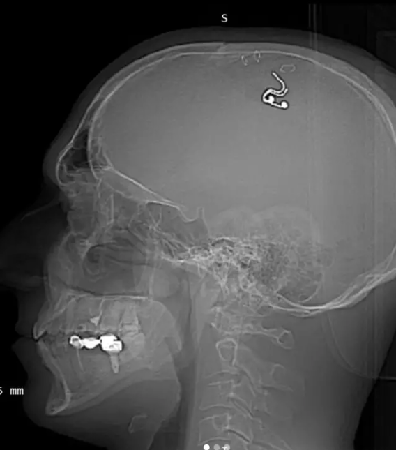 Instagram/@michael_raduga