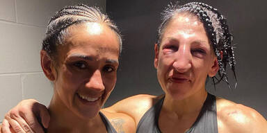 236 Volltreffer! Boxerin (33) nach Kampf entstellt