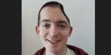 Brite verliert nach Betriebsfeier halben Kopf