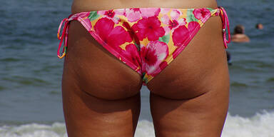 Cellulite den Kampf ansagen Orangenhaut