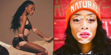 Winnie "Chantelle" Harlow