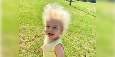 Nach Haarausfall bei Baby w&auml;chst &uuml;berraschendes nach