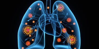 Wie das Coronavirus die Lunge zerst&ouml;rt
