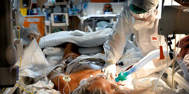 86 Corona-Tote in 24 Stunden in &Ouml;sterreich | Aber: Zahl der Neuinfektionen gesunken