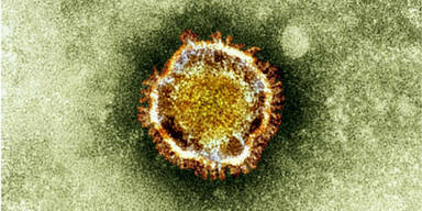 MERS-Virus: Erkrankungsfall in &Ouml;sterreich