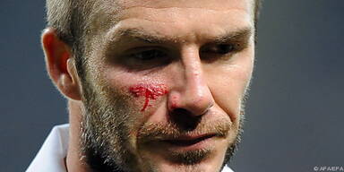 Das Cut dürfte Beckhams kleineres Problem sein