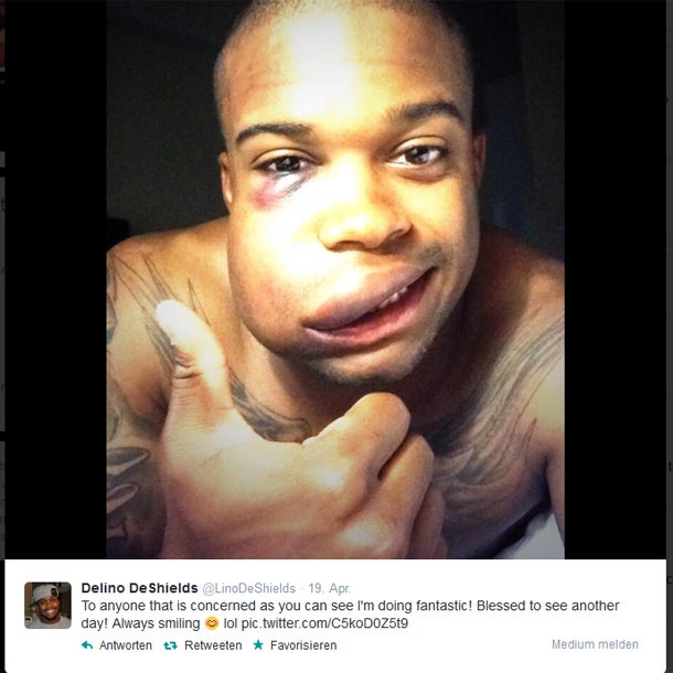 Baseball-Star DeShields twittert Schock-Foto