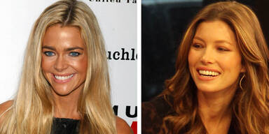 Tanorexia: Die Sucht der Stars nach Farbe