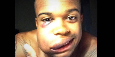 Baseball-Star DeShields twittert Schock-Foto