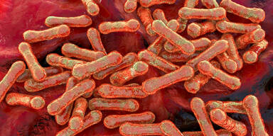 Zwei Diphtherie-F&auml;lle in &Ouml;sterreich: Eine Person gestorben