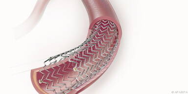 Drahtgitterr&ouml;hren halten Engstellen offen