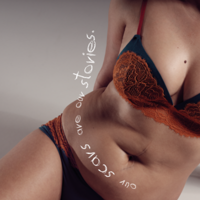 EVERY NIGHT IN SKINY 