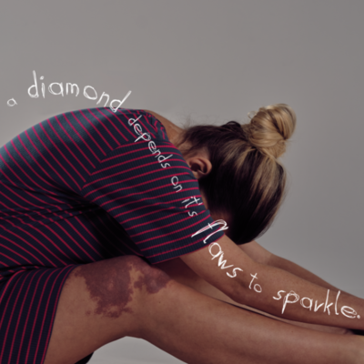 EVERY NIGHT IN SKINY 