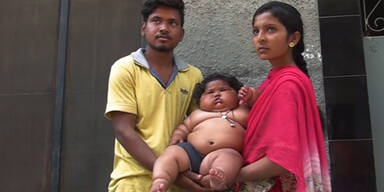 Ist SIE das fetteste Baby der Welt?