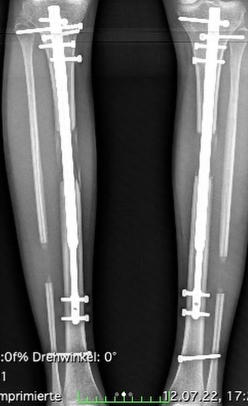 ThersiaFischer/Instagram