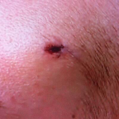 Die Opfer des Snipers